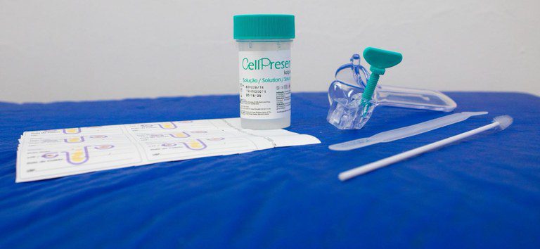 SUS passa a oferecer teste de DNA-HPV 100% nacional para detecção precoce do câncer do colo do útero